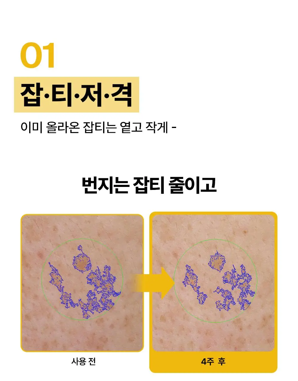 [잡티저격/TXA] 퍼셀 80억/mL 글루타치온 TXA 캡슐 크림 80ml 상세페이지 9